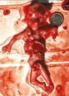 Almudi.org - Aborto